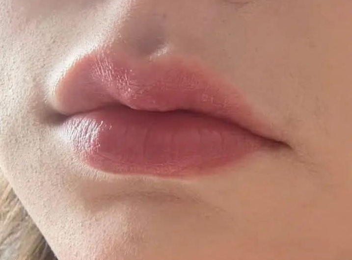 ঠোঁটের গোলাপি আভা ফিরিয়ে আনতে যা করবেন