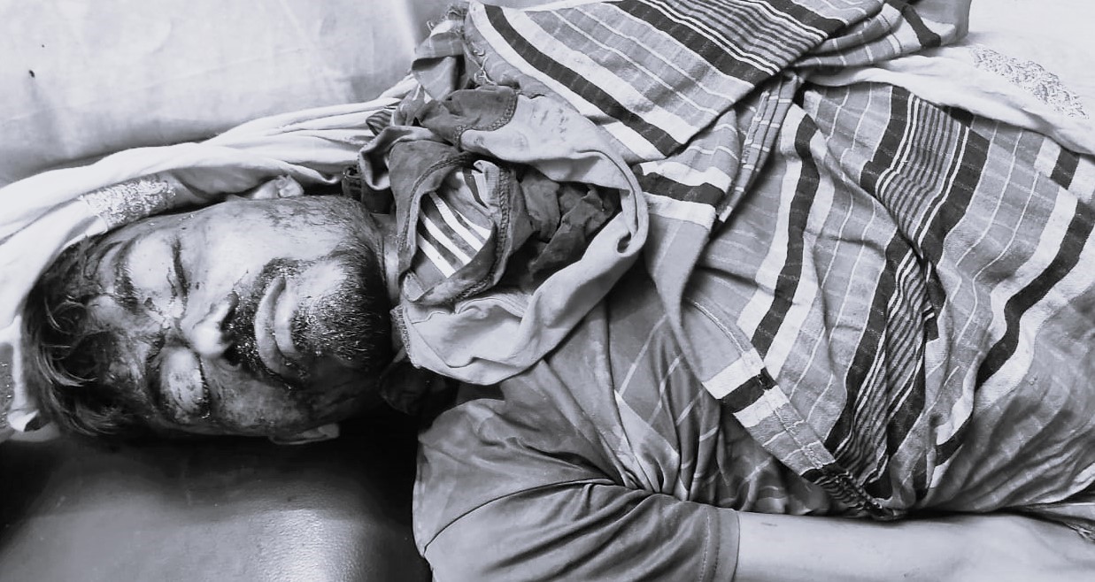 ফুলবাড়ীতে ট্রলি উল্টে চালকের মৃত্যু