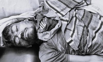 ফুলবাড়ীতে ট্রলি উল্টে চালকের মৃত্যু